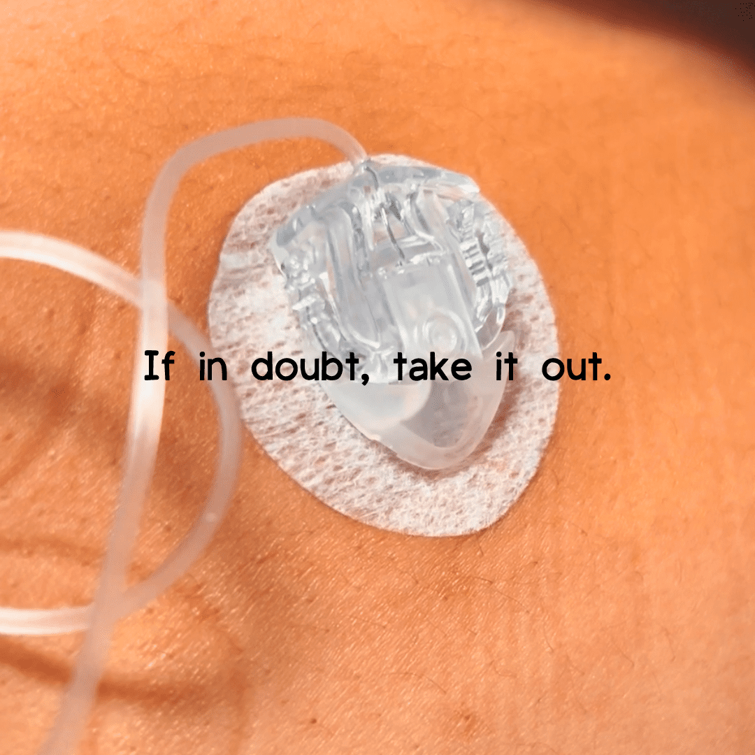 Trust Your Diabetic Gut: Why It's Essential to Listen to Your Body with Insulin Pump Sites